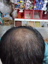 Anonymous review photo