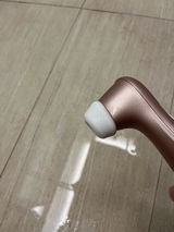 Anonymous review photo