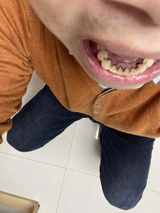 asdd adll review photo