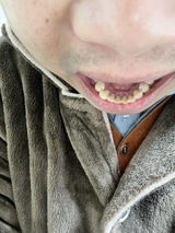 asdd adll review photo