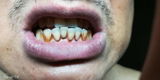 Uendy Long review photo