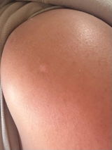 Anonymous review photo