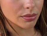 Sofie review photo