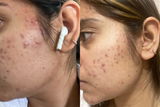 Amarpreet S. review photo