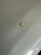 Anonym review photo