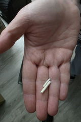 CVG review photo