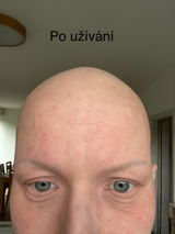 Tereza Č. review photo