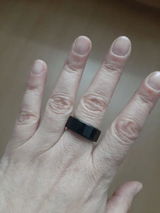 Anonym review photo