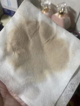 Anonymous review photo