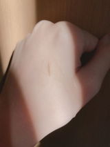 Anonymous review photo