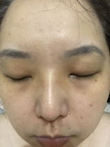 Anonymous review photo