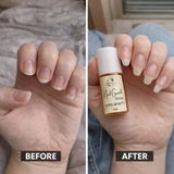 Nail Growth Serum(Rapid Growth)🔥 Free Shipping 🚚