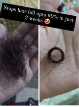 Natural Hair Growth Treatment Oil 🔥 Free Delivery  🚚