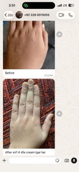 Hand & Feet Whitening Cream | Free Delivery  | Money Back Guaranted 💯