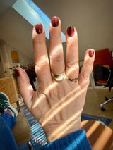 Anonymous review photo