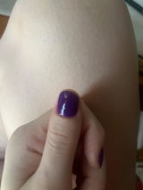 Anonymous review photo
