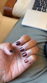 Anonymous review photo