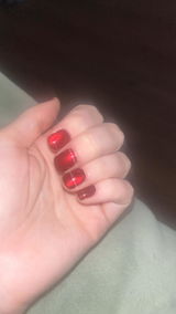 Anonymous review photo