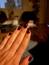Anonymous review photo
