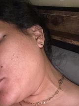 Anonymous review photo