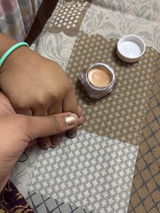 Anonymous review photo