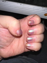 wart review photo