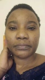 Anonyme review photo