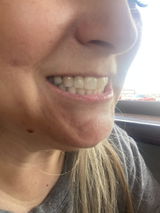Anonymous review photo