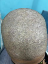 Folioxcin Anti-Dandruff Shampoo
