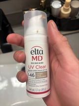 Anonymous review photo