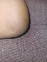 Anonymous review photo
