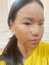 Skinzy review photo