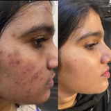 Samra Siddiqui review photo