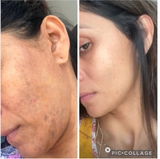 Neetii Patel review photo