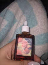 Anónimo review photo