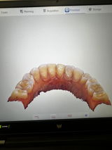 Intraoral scanner Panda P3 Plus
