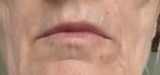 Skin Barrier Serum