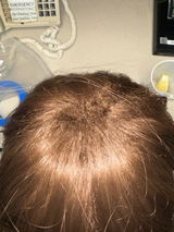 Fawn review photo
