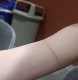 Anonymous review photo