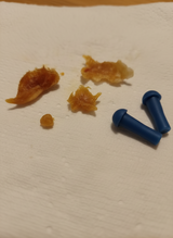 Buse A. review photo