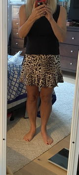 Anonymous review photo