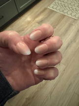 Anonymous review photo