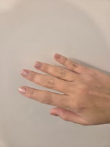 Anonym review photo
