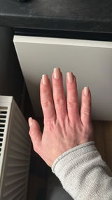 Anonym review photo