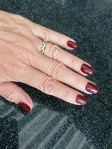 Diana Berkl review photo