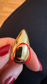 Anonym review photo