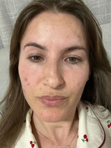 Anonymous review photo