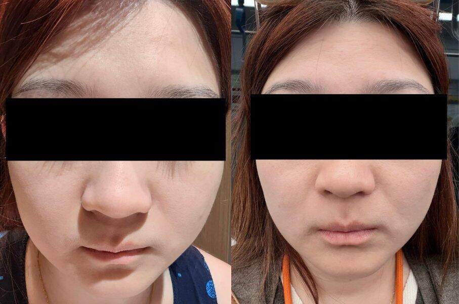 Golden Tomato Oral Sunblock - Best Skin Whitening Supplement | UV Protection, Brighten Skin & Fade Dark Spots