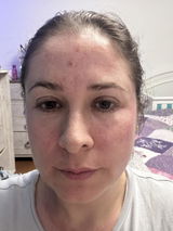 Anonymous review photo