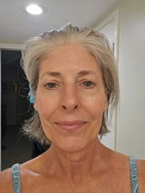 Anonymous review photo